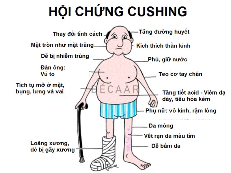 tác hại của corticoid trên da